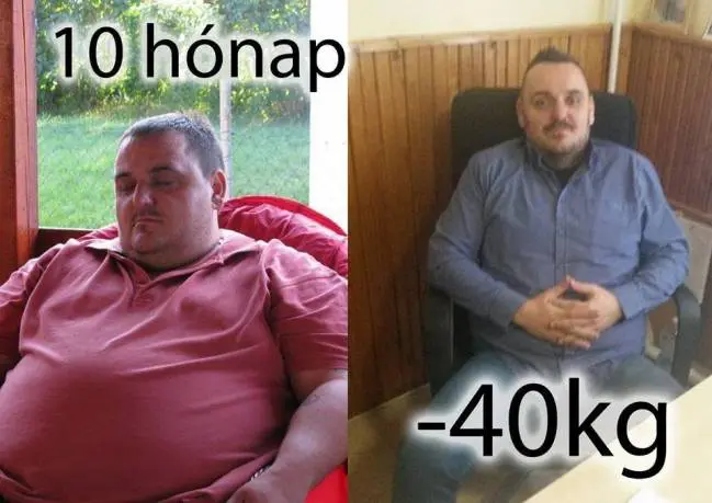 -40kg fogyás, előtte-utána