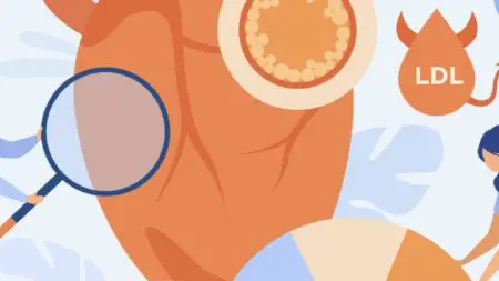 Koleszterin csökkentés gyógyszer nélkül: diéta, mozgás, kiegészítők