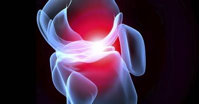 Arthritisz, avagy mi is az ízületi gyulladás?
