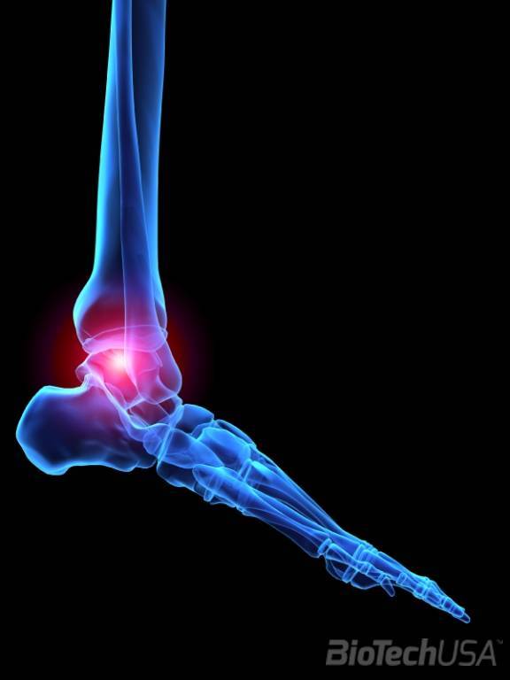 ízületi gyulladásos artrózis kezelő eszköz a kézkezelés ujjainak ízületeinek polyosteoarthrosisa