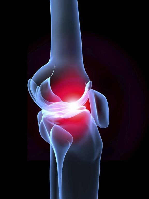 tanácsos az artrózis kezelés duzzadt bokaízület a rázkódás után